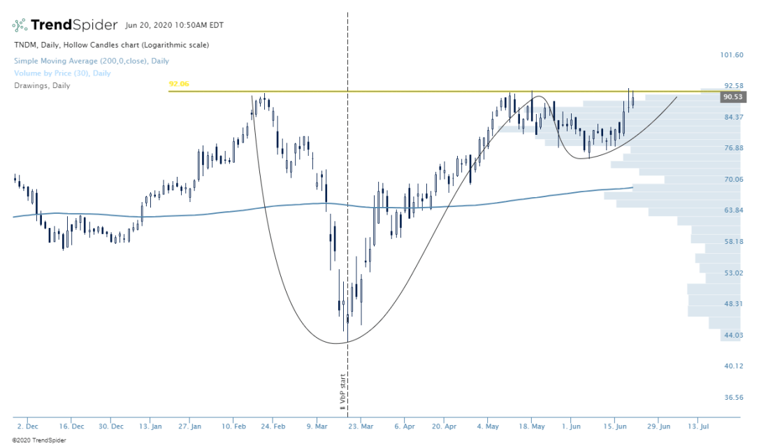 TNDM-20_Jun_2020_10_50
